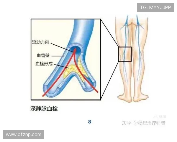 深静脉血栓阴影下21岁惠特摩尔的篮球复出前景与挑战之路评析 深静脉血栓阴影下21岁惠特摩尔的篮球复出前景与挑战之路评析